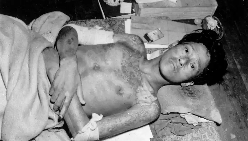 Nagasaki’den Yetkililerden Şok İhbar: Nükleer Tehdit Artıyor