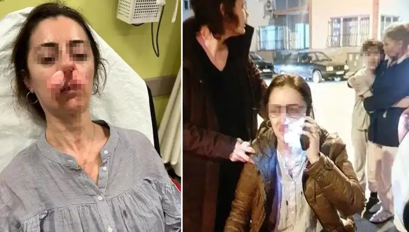 Eşini Aldatan Adamın Otomobil Kapısıyla Saldırdığı Olay Şok Etti!