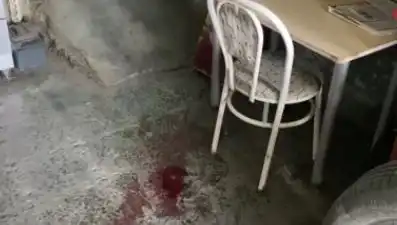 Sandalyeden Düşerek Ağır Yaralanan Adamın Şaşırtıcı Hikayesi