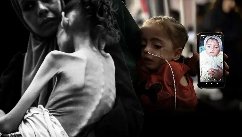 Küçük Meryem'in Açlık Savaşı: 25 Kilodan 10 Kiloya Düştü